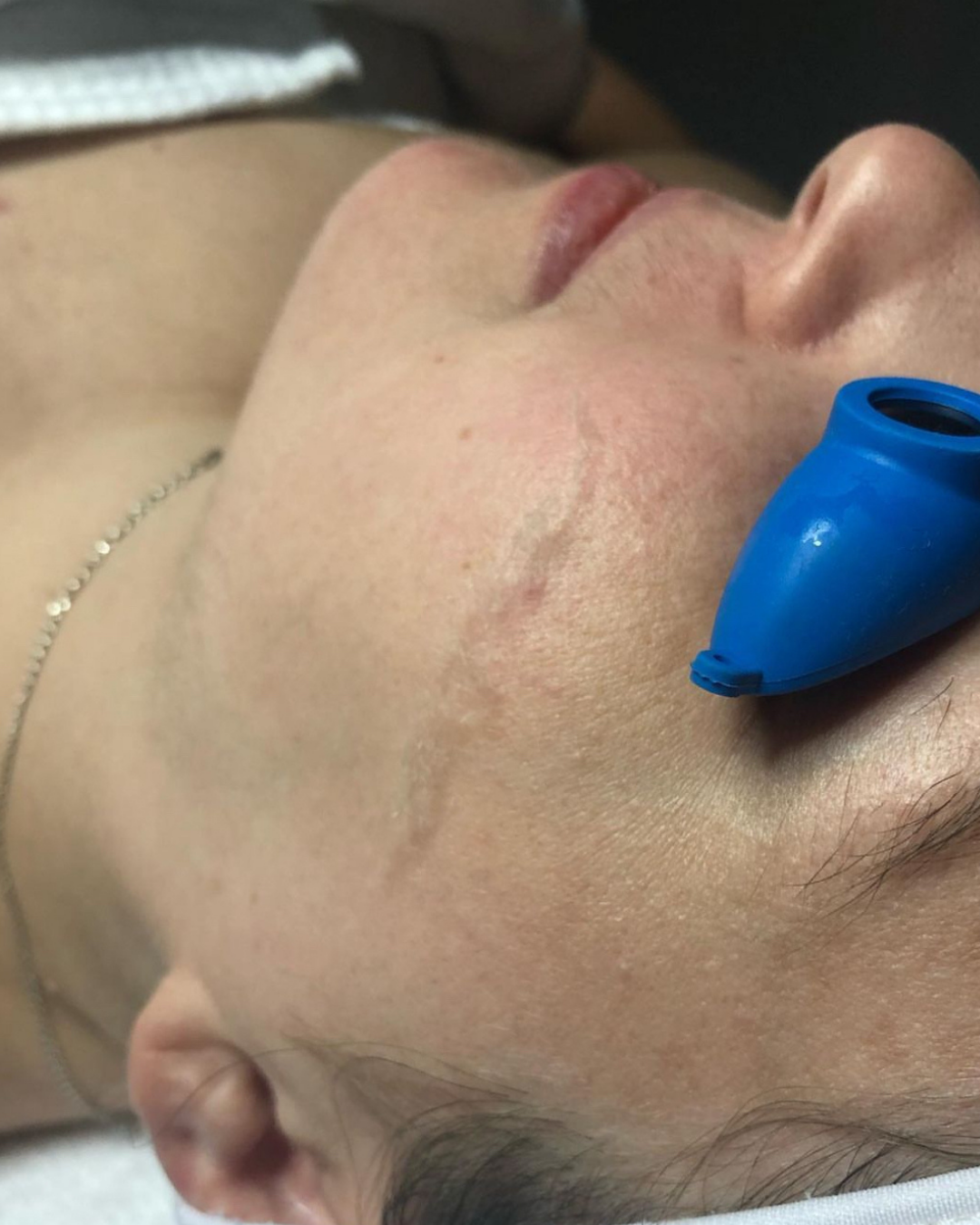 facial